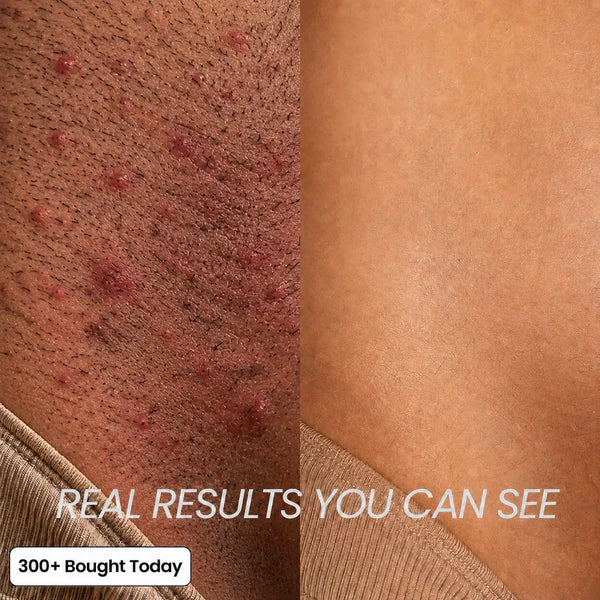Lucrown Silky Skin Oil